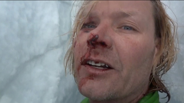 John All after falling down a crevasse in Nepal